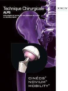 X NOV affiche pour le médical (orthopedique)